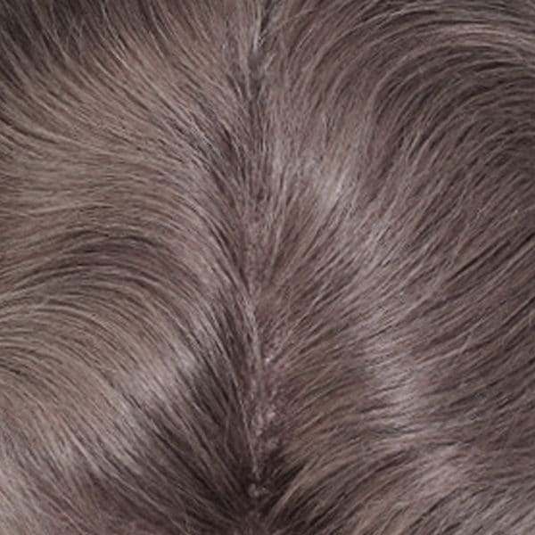 Prótesis Capilar Ross One Hair Solution